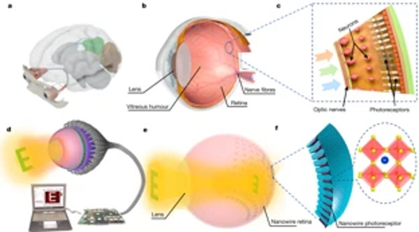 A biomimetic eye with a hemispherical perovskite nanowire array retina image