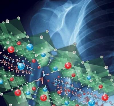 Samsung develops perovskite-based x-ray technology image